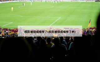 科比被烧成啥样了(科比被烧成啥样了啊)